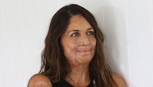 Turia Pitt