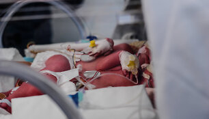 Antradienį gimusios mergytės auga inkubatoriuje