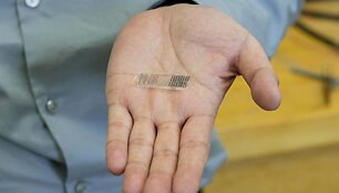 profesorius Xudongas Wangas laiko s lūžio elektrostimuliacijos prietaisą. Uždėtas ant lūžio, prietaisas generuoja elektros energiją i&scaron; judesio ir taip pagreitina kaulų gijimą. 