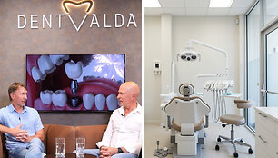 Dantų implantacija &scaron;iandien: nuo mitų iki sprendimo, kuris pakeičia gyvenimo kokybę