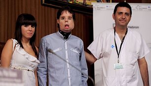 Oscaras po veido transplantacijos operacijos