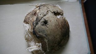 JAV mokslininkai prie&scaron; kurį laiką parei&scaron;kė, kad Rusijos archyve saugomi kaukolės fragmentai i&scaron; tiesų yra moters, o ne Trečiojo reicho vadovo.