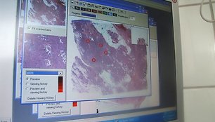 Komputerio ekrane matomas nuskanuotas mikroskopinis audinio vaizdas –– tyrejas pažymi vietas, iš kurių bus atrenkami mėginiai audinių mikrogardelių gamybai.