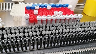 Santaros klinikų Laboratorinės medicinos centro laboratorija