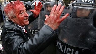 Protesto akcija Tiranoje virto kruvinomis kautynėmis.