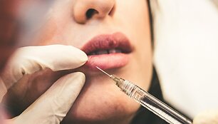 Invazinės grožio procedūros &ndash; medicinos sritis, tad jas atlikti gali ne visi specialistai