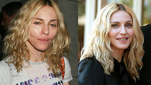 Foto naujienai: Madonna: ką gali plastinės operacijos? 