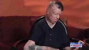 Robbie Middletonas pernai balandį mirė. 