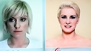 Rosita Paulauskaitė prie&scaron; ir po operacijos