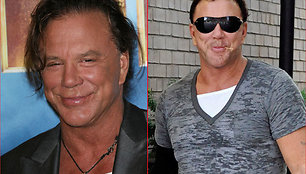 Mickey Rourke’as anksčiau ir dabar