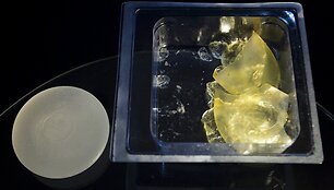 Nepanaudotas krūtų implantas (kairėje) ir po 8 metų i&scaron;imti krūtų implantai (de&scaron;inėje)