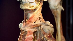 Parodos &bdquo;The Human Body Exhibition&ldquo; eksponatas