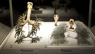 Parodos &bdquo;The Human Body Exhibition&ldquo; eksponatas