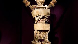 Parodos &bdquo;The Human Body Exhibition&ldquo; eksponatas