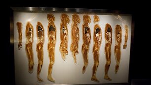 Parodos &bdquo;The Human Body Exhibition&ldquo; eksponatas