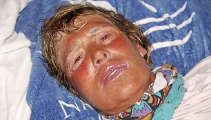 Medūzų sugelta Diana Nyad