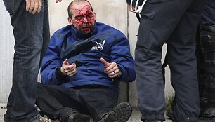 Sužeistas protestuotojas