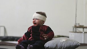 Damaske per raketų sprogimus sužeistas berniukas
