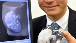 Tomohiro Kinoshita su trimačiu vaisiaus modeliu