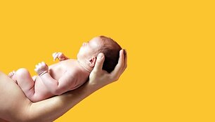  Pasaulį kasmet i&scaron;vysta tūkstančiai vaikų, neturinčių ai&scaron;kios lyties. 