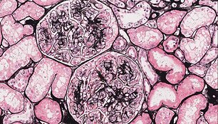 Inkstų glomerulų membranas i&scaron;ry&scaron;kinantis dažymo metodas