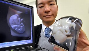 &bdquo;Mados klyksmas&ldquo; Japonijoje &ndash; būsimojo kūdikėlio 3D atvaizdas