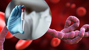 Ebola