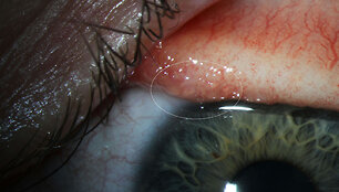 Eye_Worm_59884.jpg-d0447