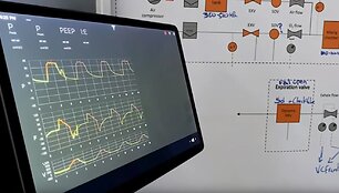 &bdquo;Tesla&ldquo; parodė sukurto plaučių ventiliatoriaus prototipą