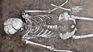 Skeletas
