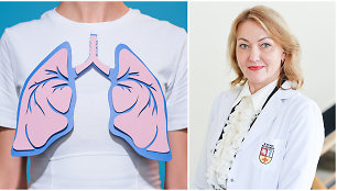Asta Aukštakalnienė kalba apie lėtinę obstrukcinę plaučių ligą