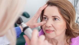 Gydytoja – apie glaukomą: pacientui kreipusis per vėlai, nebegalima užkirsti kelio aklumui