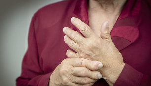 Reumatoidinis artritas
