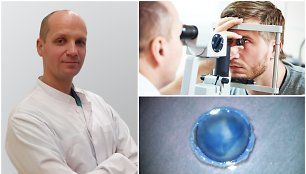 Akių ligų centro gydytojas Almantas Makselis (kairėje) – apie atliekamas endotelio transplantacijas
