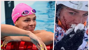 Julija Jefimova patyrė traumą, bet ne plaukimo baseine.