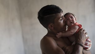 Zika virusu užsikrėtęs kūdikis Brazilijoje