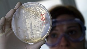 E.coli bakterijos
