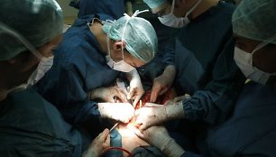 Kepenų transplantacijos operacija