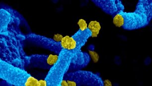 I&scaron; pacientės gerklės tepinėlių paimtas virusas gebėjo daugintis laboratorinėje žmogaus ląstelių terpėje
