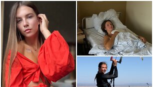 Aktyviai gyvenanti Alina tiki, kad ir su &scaron;irdies stimuliatoriumi galės daryti tai, ką mėgsta