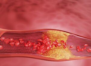 &Scaron;ie 4 produktai turi ypač daug cholesterolio: medikai pataria į burną neimti