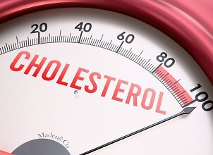 Padidėjęs cholesterolis? Kardiologai maldauja 3 dalykų atsisakyti nedelsiant