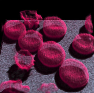 Gražvydo Lukinavičiaus nuotr./Naujai sukurtu fluorescuojanciu dažu nudažytas citoskeleto baltymas aktinas puikiai matomas gyvuose raudonuosiuose kraujo kūneliuose (eritrocituose).