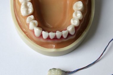 Krūminiai dantys