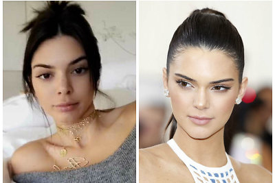 Kendall Jenner dabar ir anksčiau