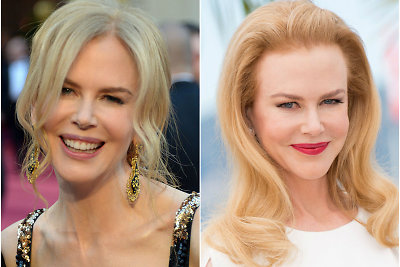 PRIEŠ ir PO: injekcijų sudarkytos Nicole Kidman lūpos pamažu dailėja