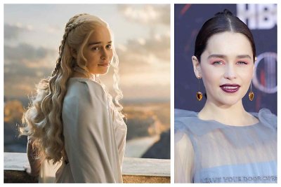 „Sostų karų“ žvaigždė Emilia Clarke pasidalijo išgyvenimais ir nuotraukomis po patirtos smegenų aneurizmos