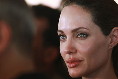 Angelinos Jolie teta serga krūties vėžiu