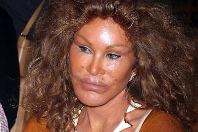 Mirė milijonus plastinėms operacijoms išleidusi Jocelyn Wildenstein – „moteris-katė“