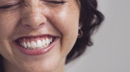 Sprendimas alergiškiems žmonėms – keraminiai dantų implantai